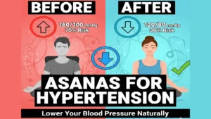 Asanas For Hypertension